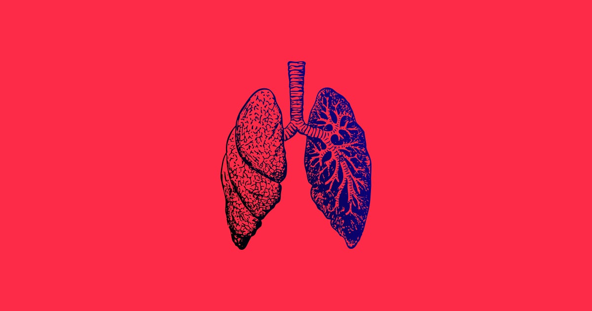 A very small study found that some patients who recover from the coronavirus could face long-term lung damage and reduced lung capacity.