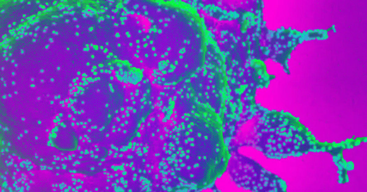 South Korean infectious disease experts claim that reports of citizens being reinfected by the coronavirus were likely to based on flawed tests.