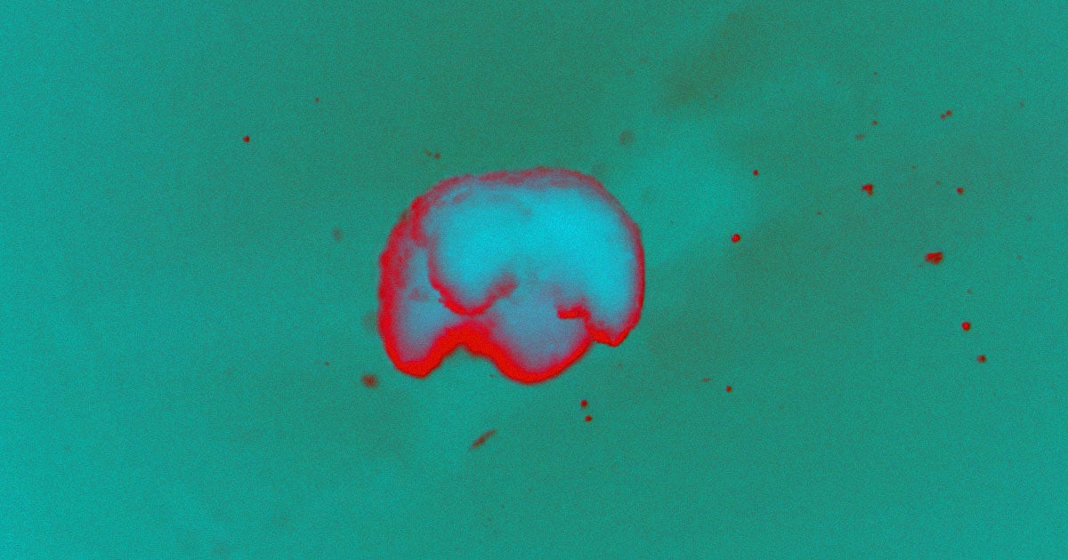 Xenobots mark a major step forward in biological robots. The tiny, short-lived creatures are designed in a virtual world then 3D printed with living cells.