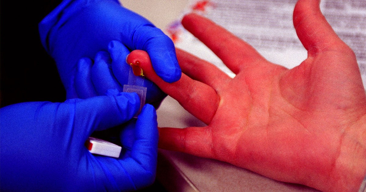 Pastor and author Brandon Robertson recently got an antibody test for COVID-19. We caught up with him about the experience and his thoughts on the future.