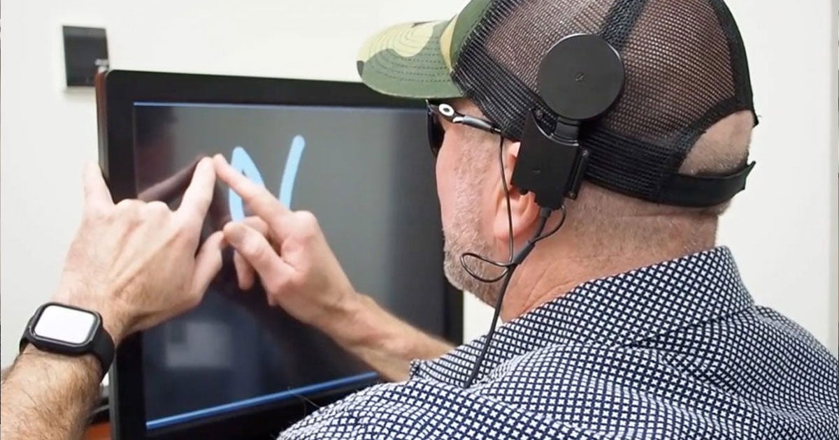 Scientists have developed a brain implant that allowed the blind and previously sighted participants who lost their sight in adulthood "see" letters.