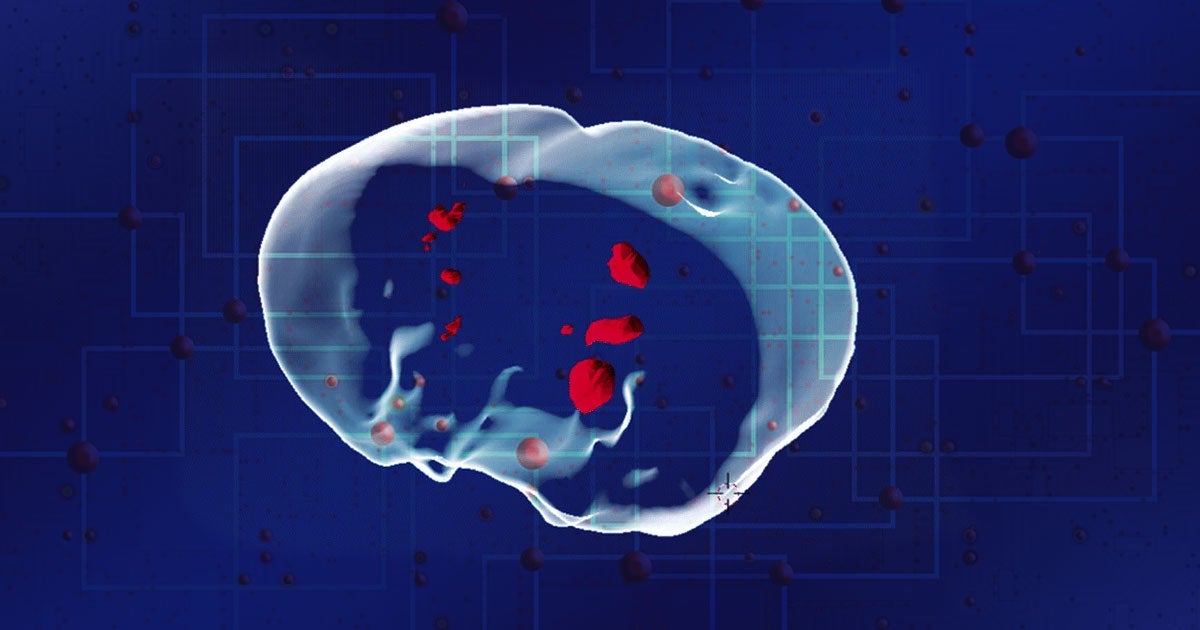 Engineers built tiny, iron nanobots that they can implant and track inside a patient's body, which they say could be used to kill off cancer cells.