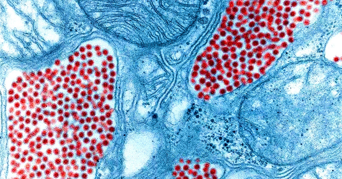 Eastern equine encephalitis (EEE) virus infections are on the rise in the Northeastern United States, in large part thanks to global warming.