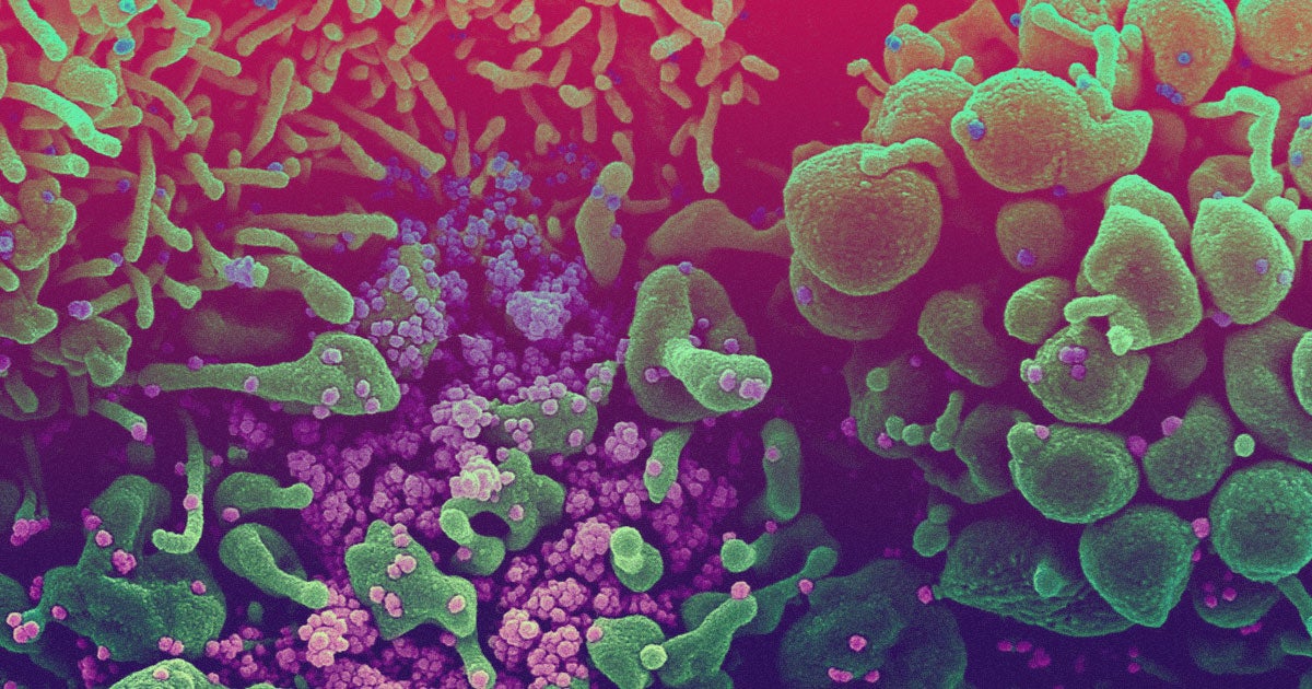 New research suggests that coronavirus antibodies and survivor's immunity could fade away after just two to three months.