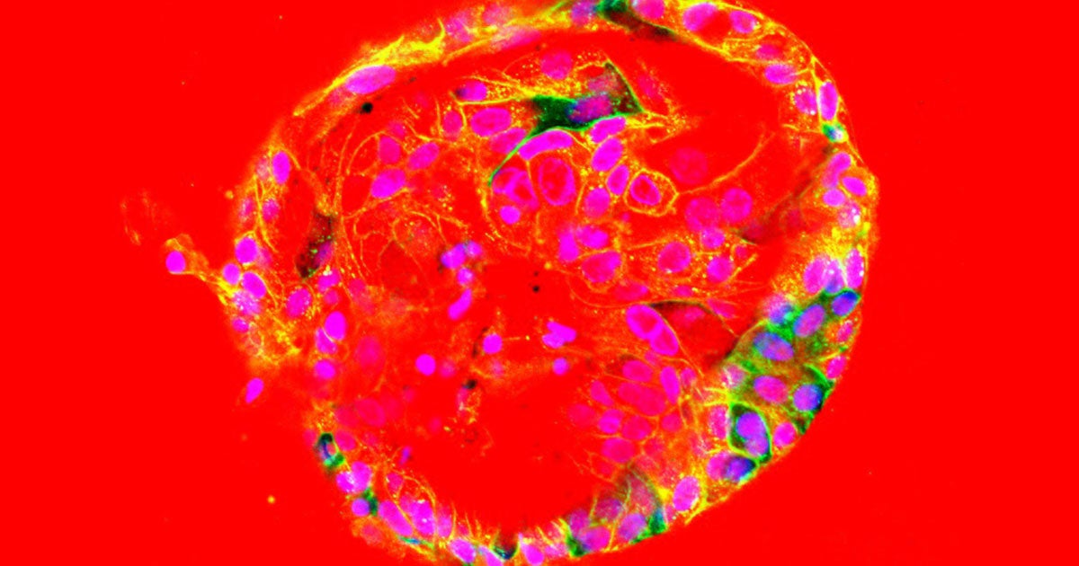 Scientists are infecting mini-organs with COVID-19 to better understand how the virus infects and interacts with human organs.