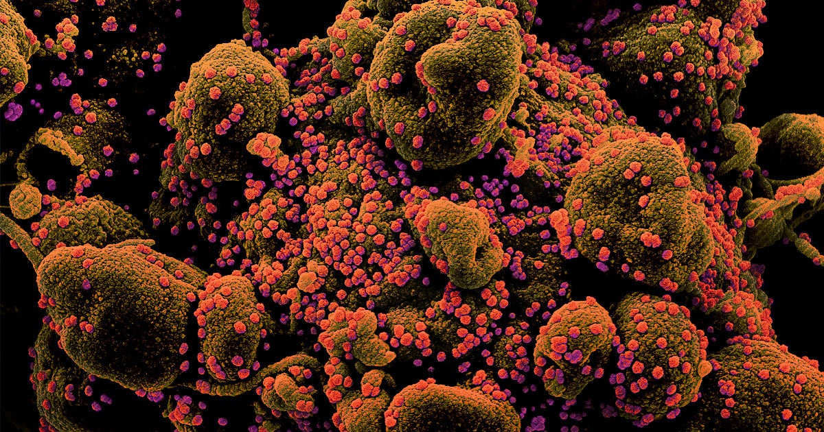 New research shows that, without lockdowns, the U.S. would have likely had nearly 5 million more cases of the coronavirus by early April.