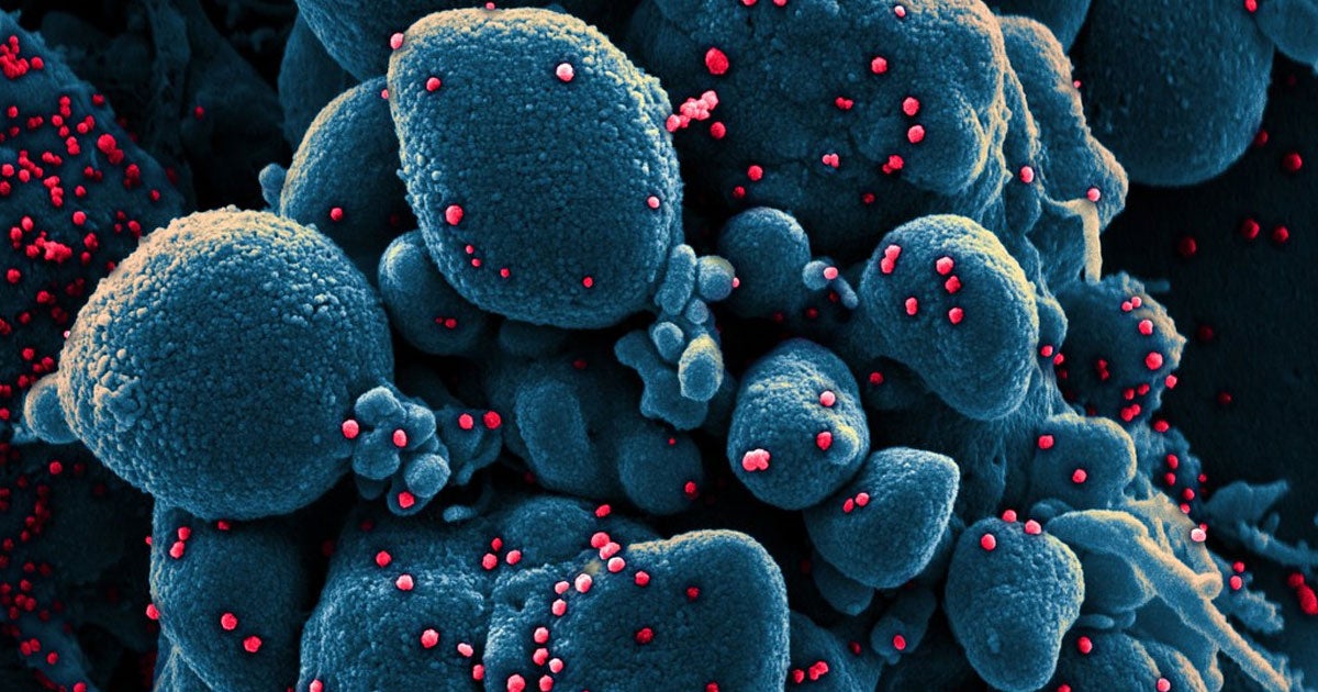 Multiple scientists have found that greater humidity seems to block the coronavirus from spreading, but experts warn against complacency if cases drop.