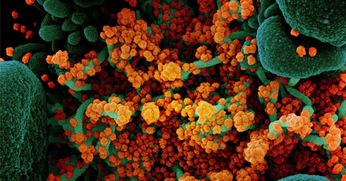 A team of German scientists are throwing a tightly-controlled concert in order to understand how COVID-19 can spread in large crowds.