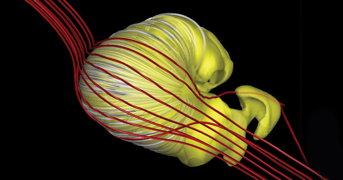 According to new research, the shape of our solar system's heliosphere could resemble a "deflated croissant," not a comet with a long tail.