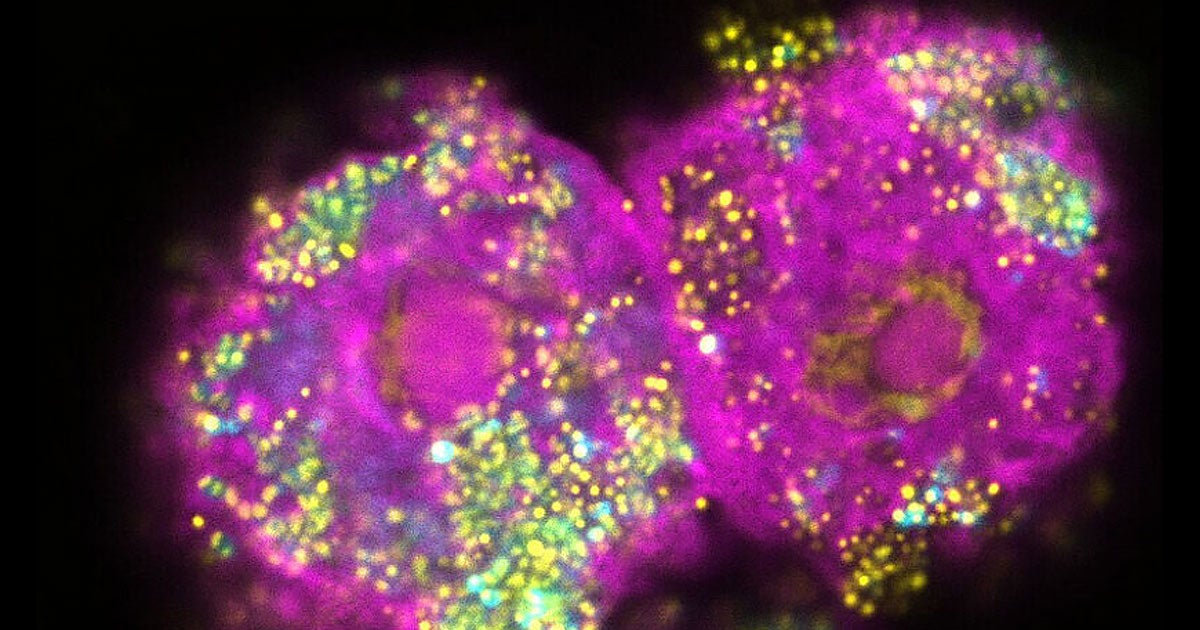 Scientists saw bacteria subjected to different conditions rapidly develop different evolutionary strategies, helping explain why some become dangerous.