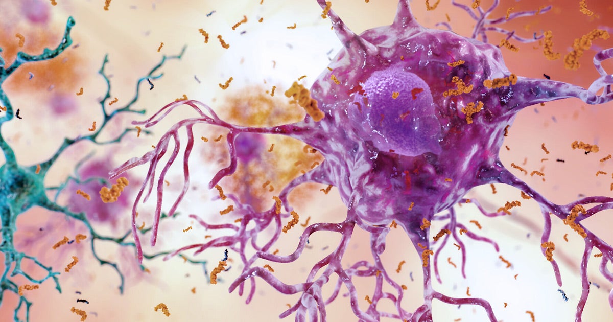 Scientists uncovered a series of epigenetic changes that seem to predict late-onset Alzheimer's disease, hinting at the possibility of future treatments.