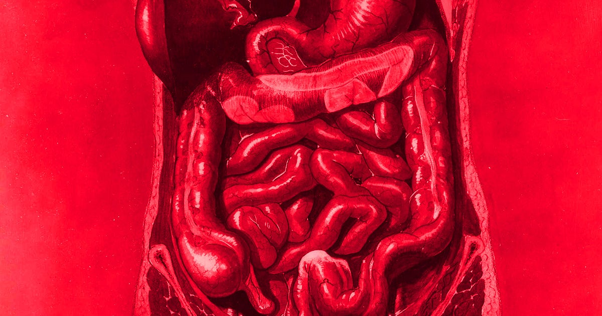 New research links Parkinson's Disease dementia to the activity of a specific hormone found in our guts, perhaps leading to new treatments or diagnostics.