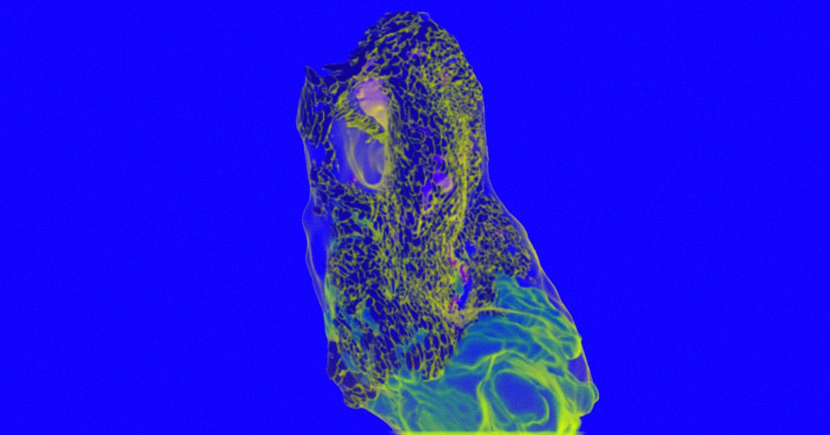New high-resolution brain scans enabled doctors to discover a new organ hiding in the human skull: a fourth pair of salivary glands.