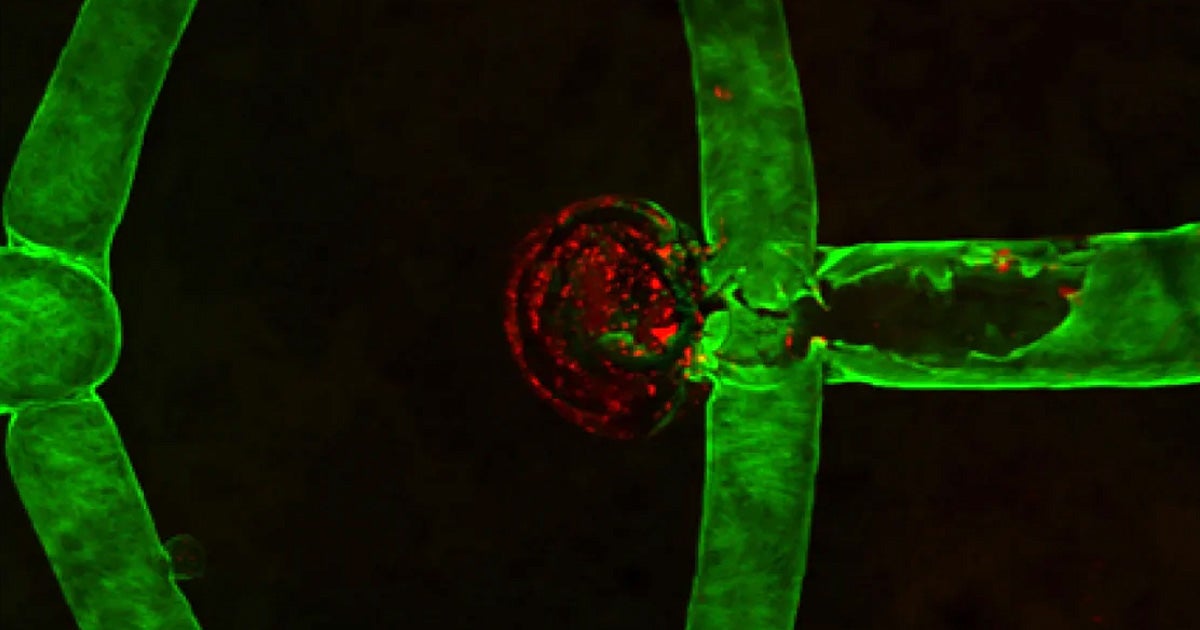 To come up with new ways to treat aneurysms and improve on existing treatments a team of researchers developed the first-ever living 3D-printed aneurysm.