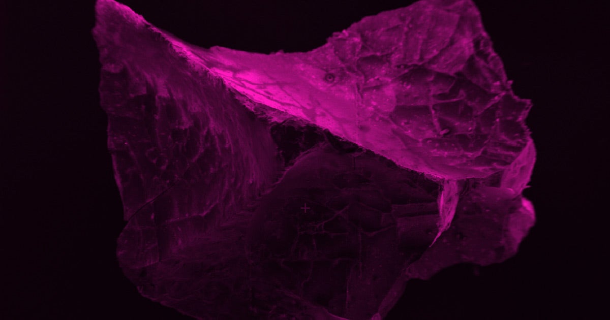 A team of scientists found individual neurons that had been turned into glass in the brain matter of an ancient Mount Vesuvius victim.