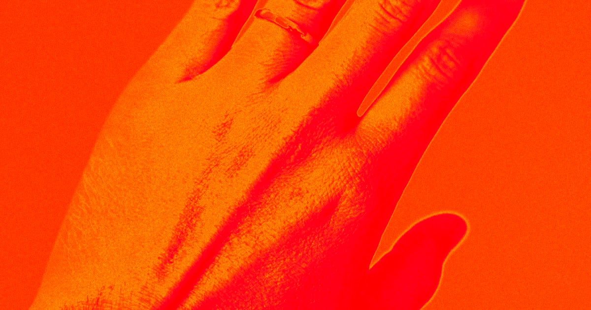 A team of scientists developed new wearable sensors that can be manufactured directly onto someone's skin — without burning the recipient in the process.