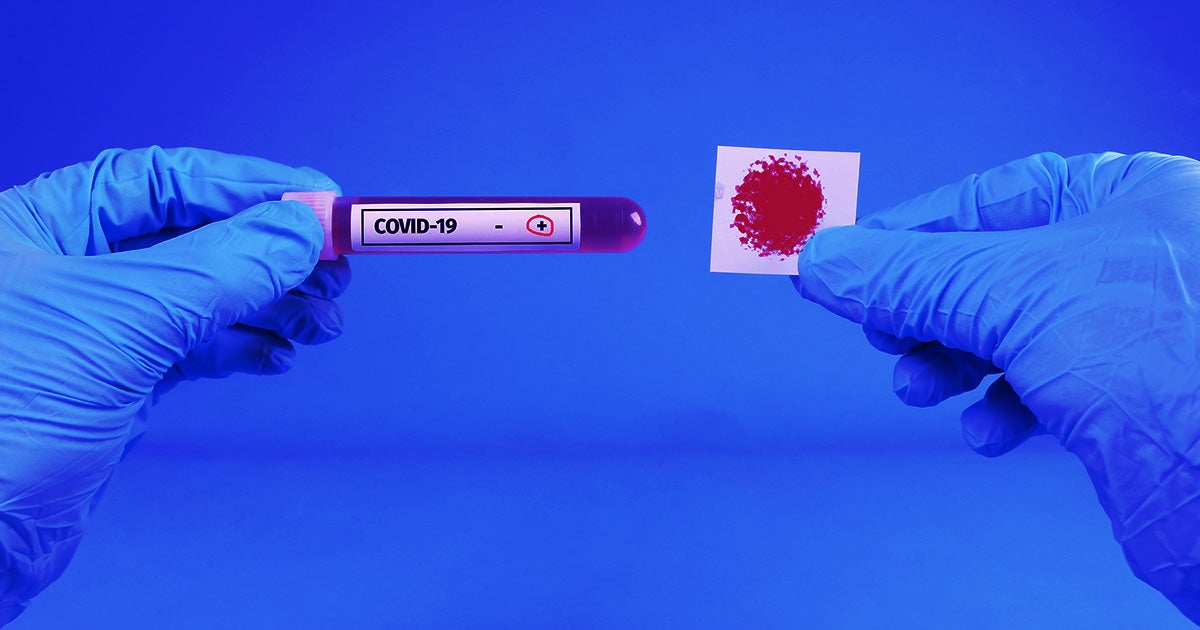 Recently, several reports emerged in Europe and the U.K. about people buying forged coronavirus tests or doctoring their own results to board flights.