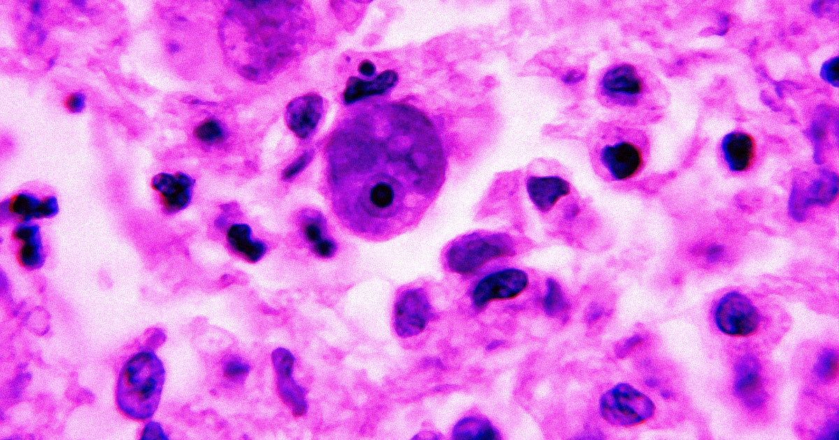 According to a new study by researchers from the CDC, "brain-eating amoeba" are slowly making their way northwards from the southern United States.