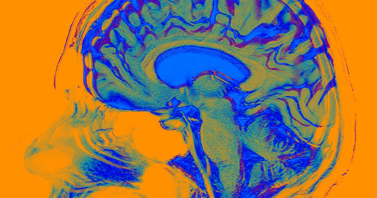 Yet another study suggests there's a strong condition between COVID-19 and a variety of psychiatric and neurological conditions.