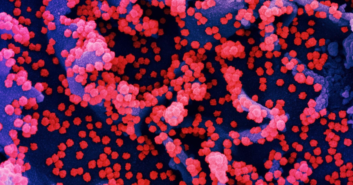 According to UK experts, the fast spreading B117 variant of the coronavirus may increase the death rate by 30 to 40 percent.