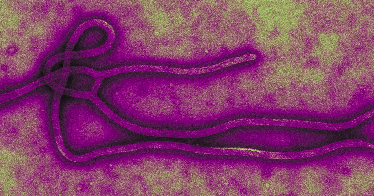 Guinea declared that it's facing a new Ebola epidemic on Sunday after seven people caught the infectious disease and three died.