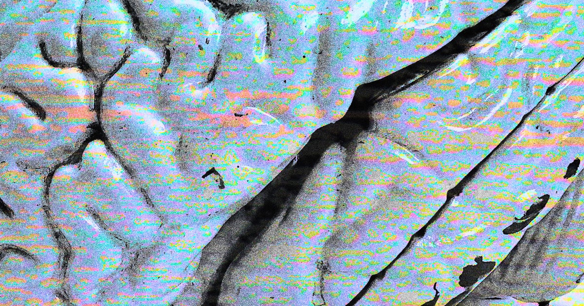 IBM developed an algorithm that can predict who might develop Alzheimer's disease by spotting changes in their writing style.