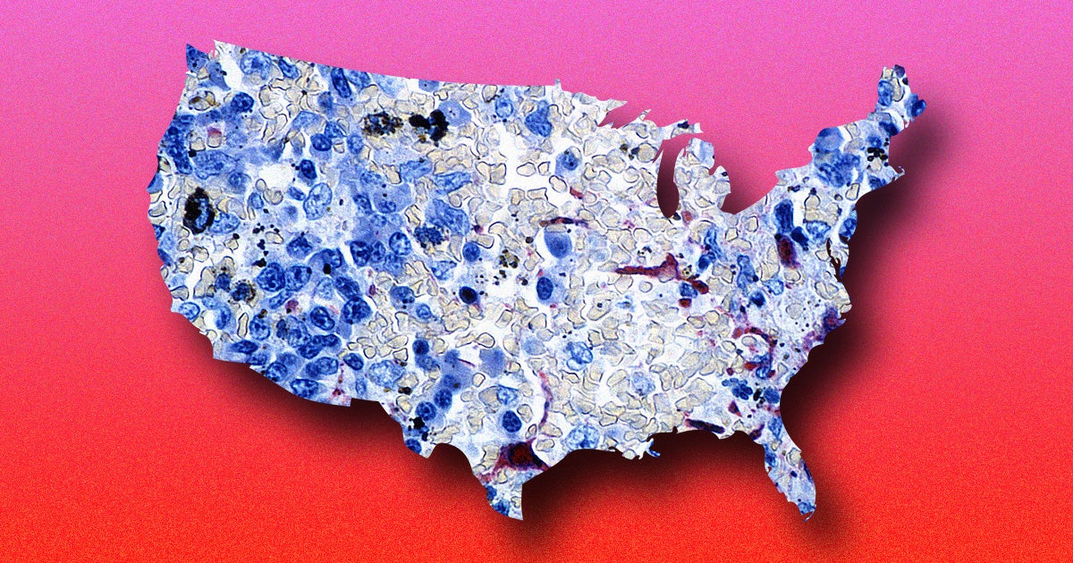 Top infectious disease expert Anthony Fauci put the United States' failure to reign in the virus into a global perspective during a Monday interview on ABC.