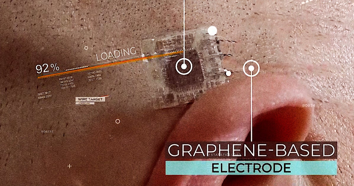 A company Brain Scientific is developing an "e-tattoo" that can be injected under the skin in epilepsy patients and scan their brains for looming seizures.