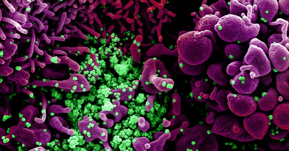 A team sent by the World Health Organization to investigate the origins of COVID-19 announced that it's "extremely unlikely" that the virus came from a lab.