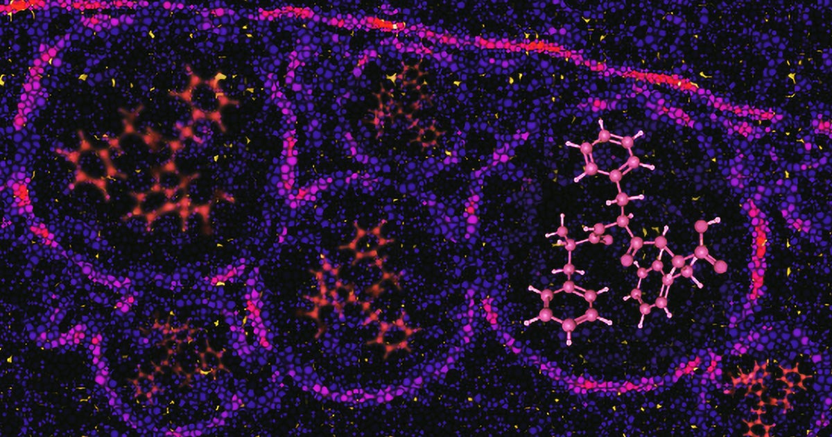 Nanoprobes called bioharmonophores can seek out and bind to cancer cells, making them glow brightly under medical scanners.