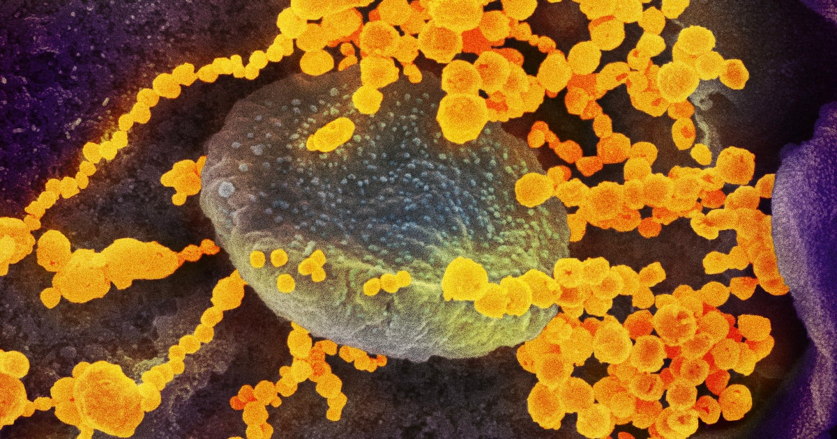Preliminary data suggests that the coronavirus variant P.1 is capable of reinfecting people who already survived COVID-19.