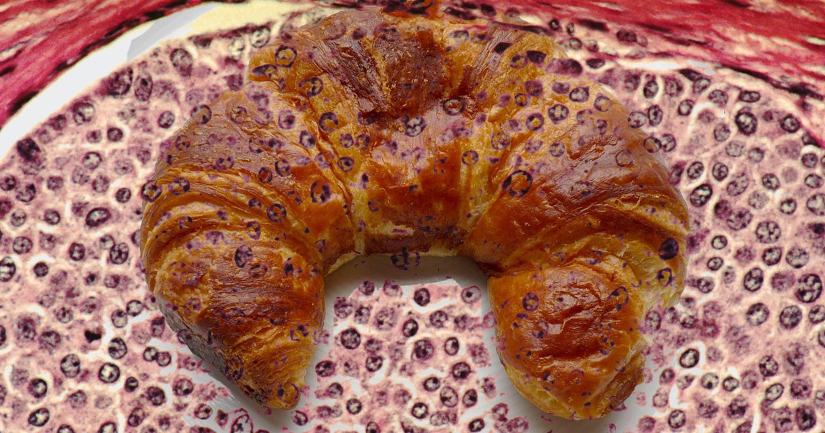 An AI system originally designed to distinguish between different types of pastry in Japan in 2013 was adapted to identify cancers.