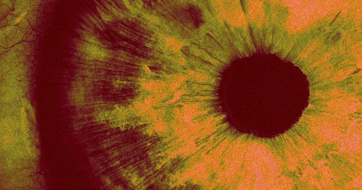 Scientists accidentally discovered that their experimental gene therapy could restore a blind patient's vision for over 15 months.