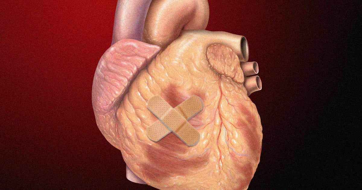 A team of researchers in Sydney have identified a new gene in zebrafish that could allow human hearts to repair themselves following a heart attack.
