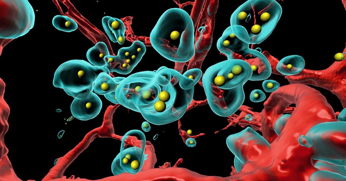 Researchers at the University of Zurich have modified a common respiratory virus called the adenovirus to eliminate tumors from the inside out.