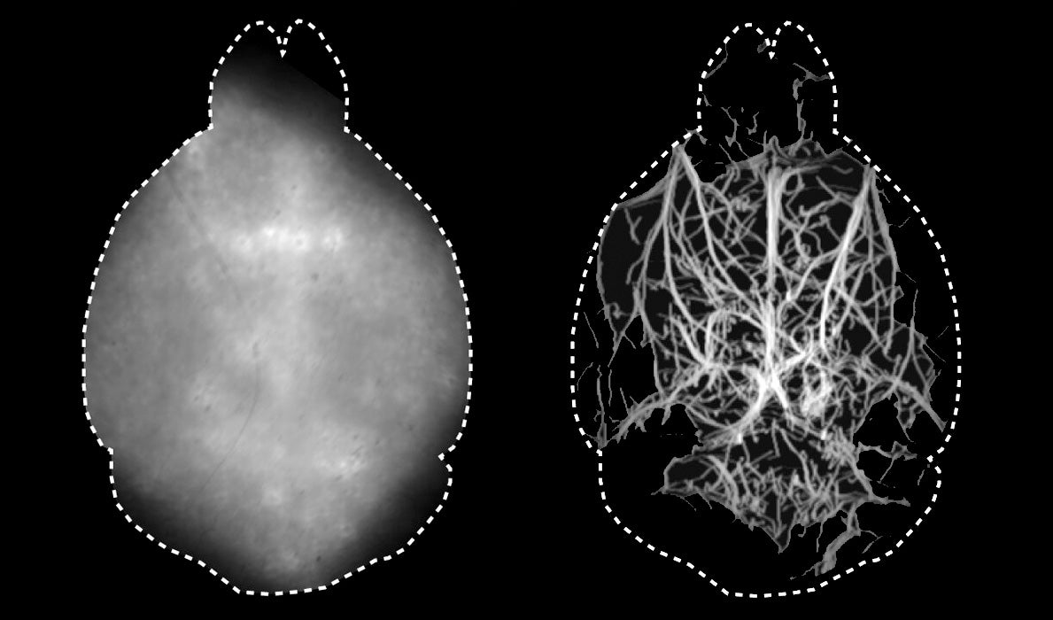 Scientists found a way to directly image a living mouse brain with a fluorescent microscope without having to conduct invasive surgery.