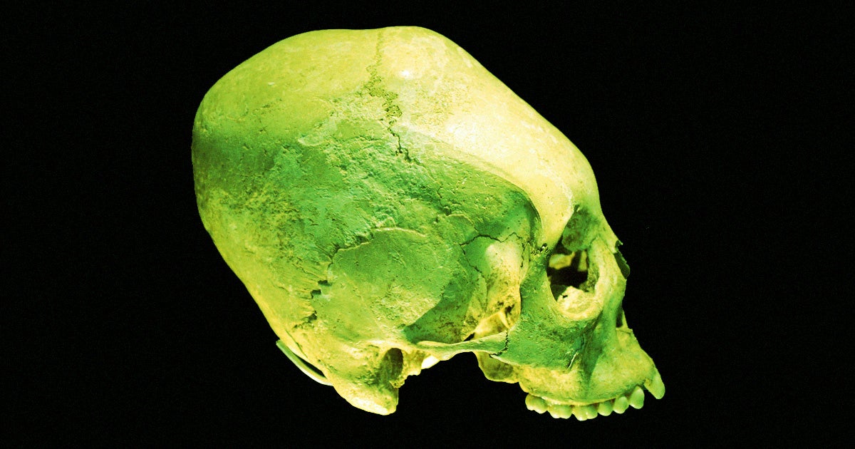 A viral post claims that odd-looking skulls are evidence of alien life, but an expert say that the skulls came from plain old human beings.