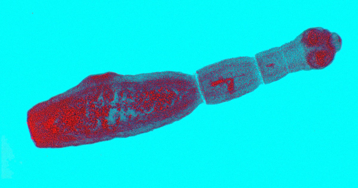 According to recent research, a cancer-like parasitic disease caused by tapeworms was identified in patients in the Canadian province of Alberta.