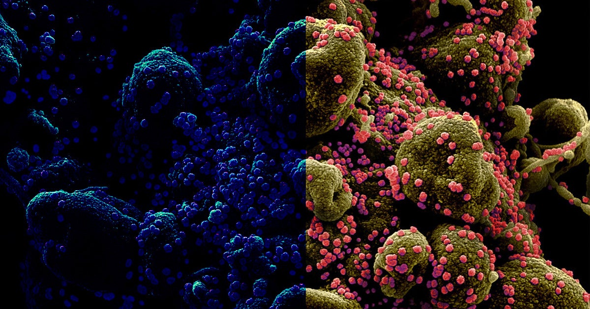 According to a new analysis, early genetic sequences linked to the initial outbreaks of the coronavirus in Wuhan were mysteriously deleted.