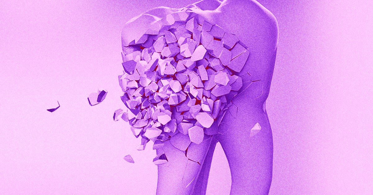 Scientists at the University of Washington plan to launch clinical trials on a breath mint that actually regrows lost tooth enamel.