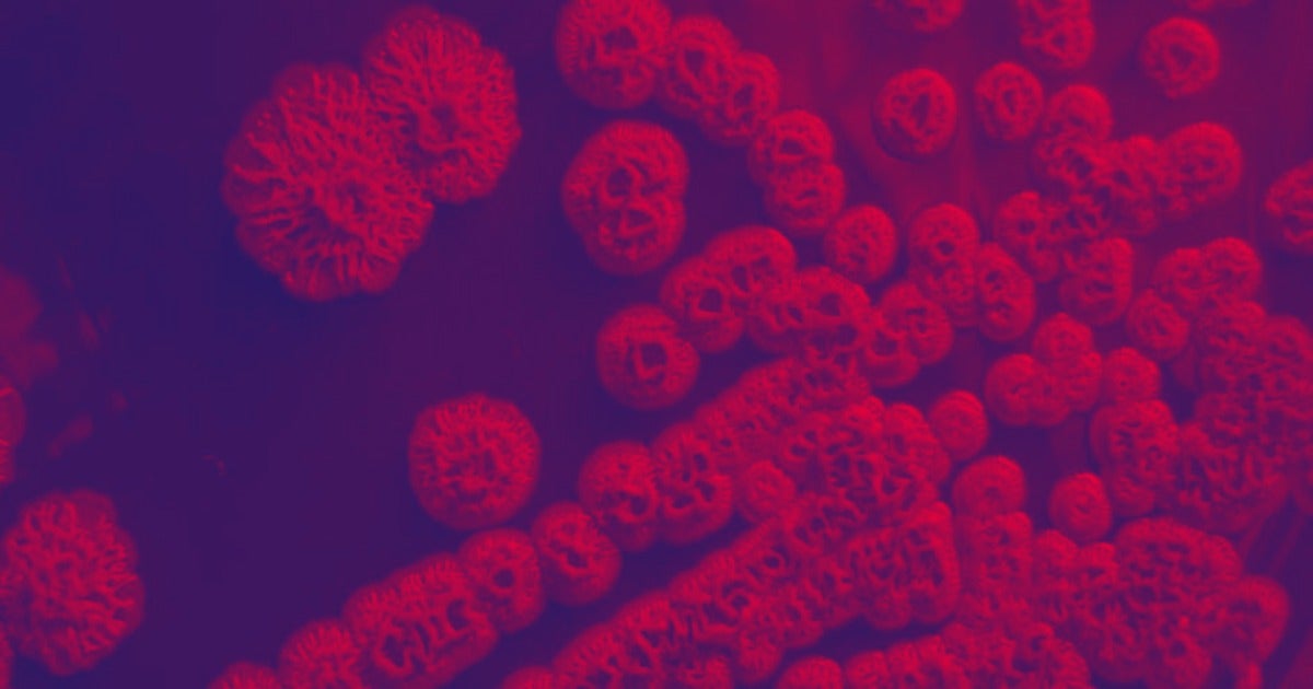 The Centers for Disease Control and Prevention announced it's investigating a rare but deadly bacterial infection in the United States.