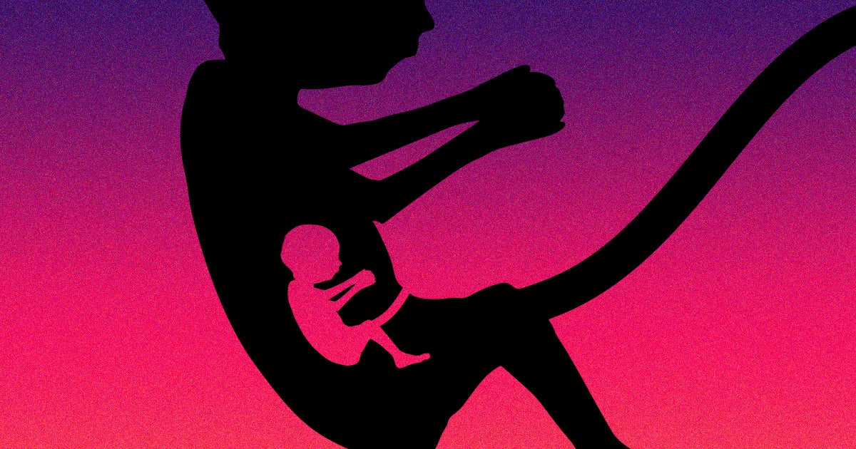 A baby was born in Israel with a partially developed human embryo — possibly the makings of an absorbed twin — inside of her stomach.