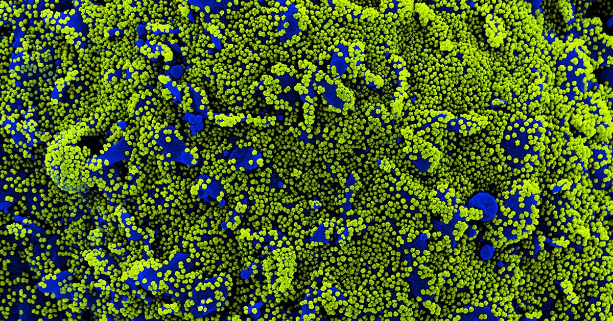 Preliminary research suggests a possible answer for why the delta variant of COVID-19 is so much more infectious than others.