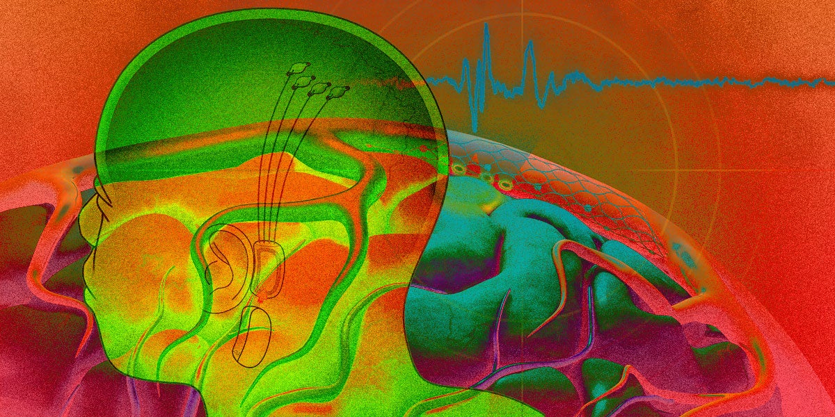 Synchron CEO and founder Thomas Oxley explains how his neural implant startup beat Neuralink in the race to achieve FDA approval.