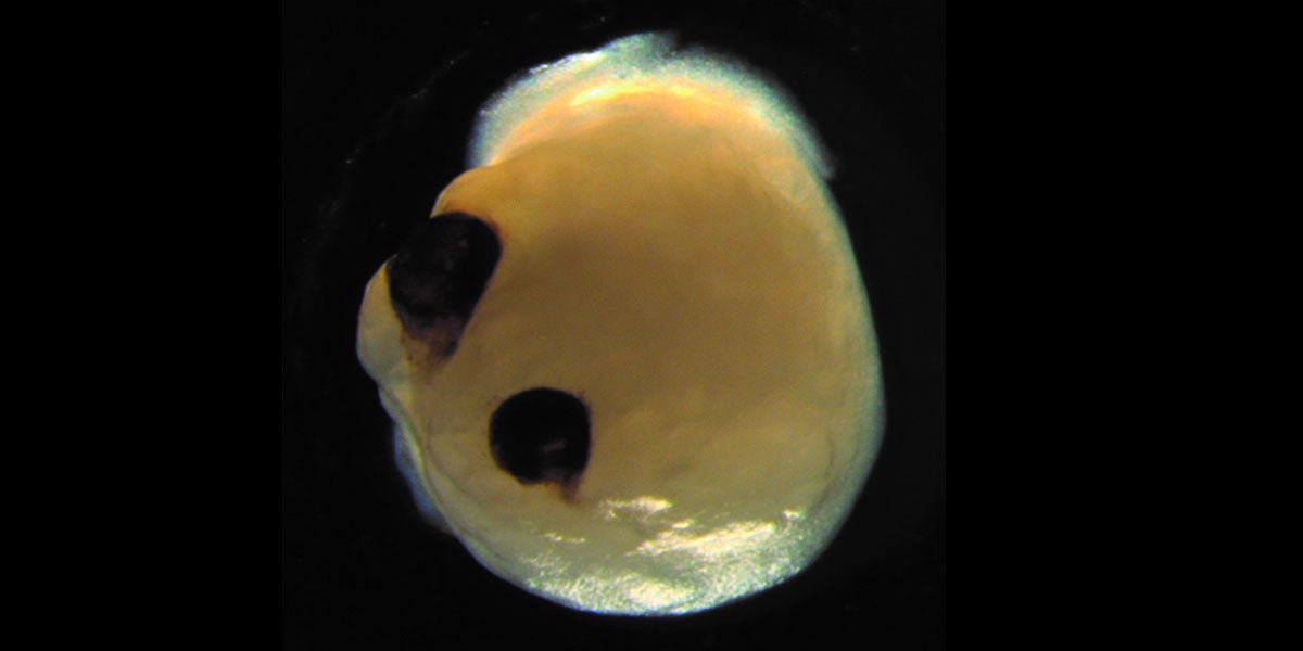 Scientists have successfully grown brain organoids — tiny, three-dimensional tissue cultures that mimic the real thing — each with their own set of 'eyes.'