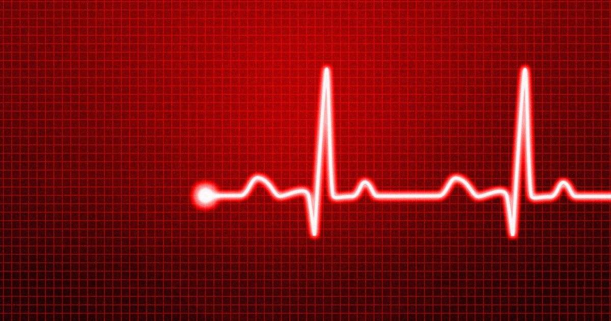 Kathy Patten suffered a heart attack and spent 45 long minutes clinically dead. But some intense CPR actually managed to bring her back to life.