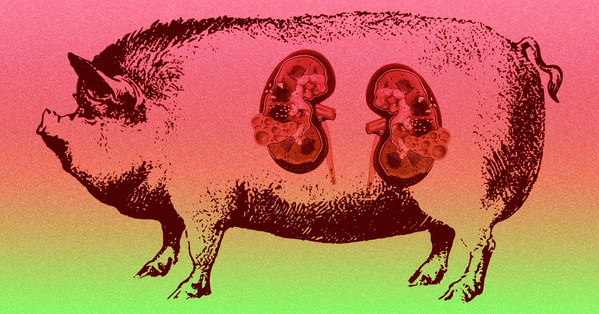 For the first time ever, doctors have successfully transplanted a kidney from a pig to a human — and found that the organ functioned normally. 
