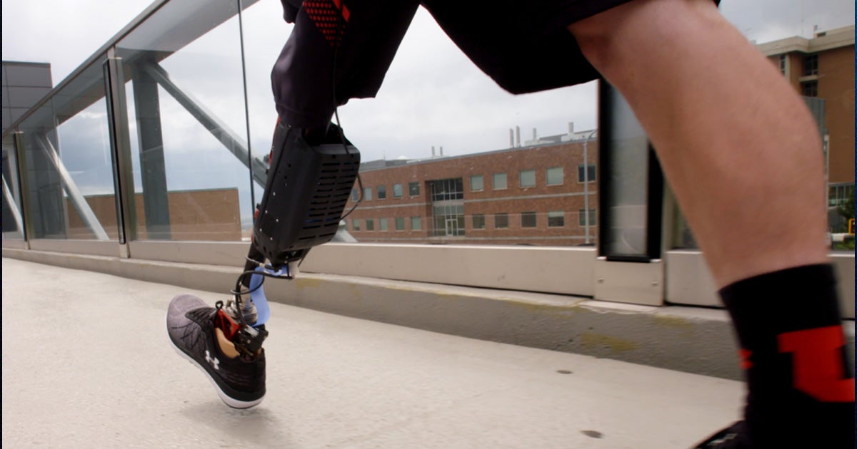 A new robotic exoskeleton allows people with amputated legs to walk naturally by giving them a small boost as they take steps forward.