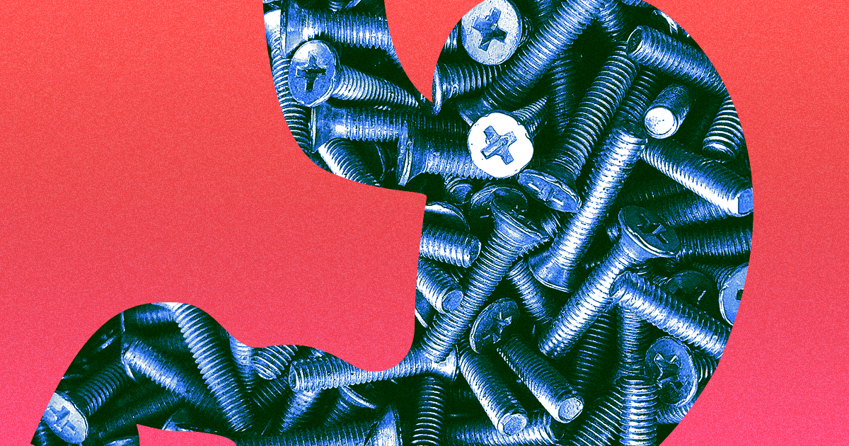 A man recently showed up to the hospital to have over two pounds of metal nails, screws, and other miscellanea removed from his stomach.