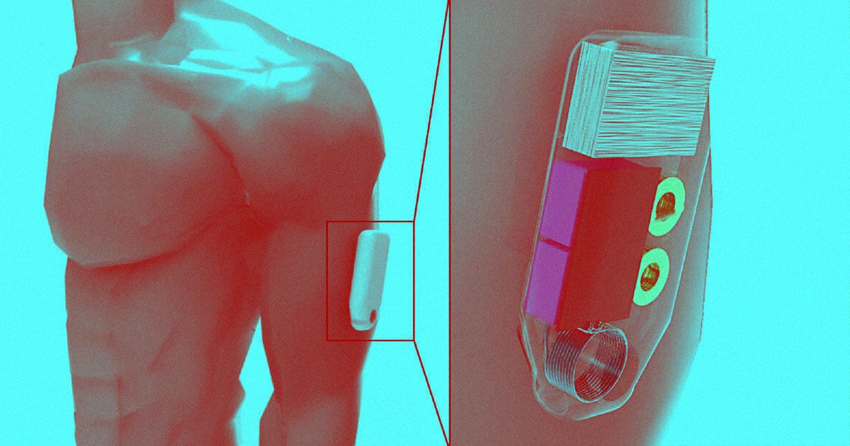 Researchers are developing a lifesaving automatic Narcan injector that may bring harm reduction into the world of medtech.